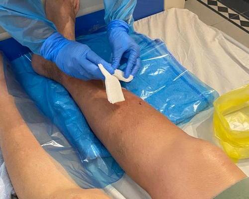 Wound Care - Home Care